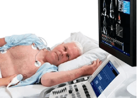 Ecocardiograma en Monterrey e1770316395276